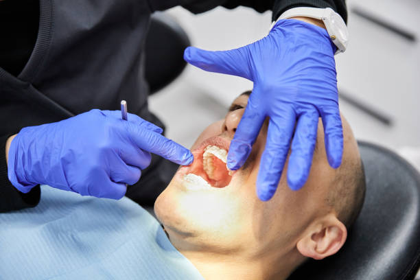 Best Broken or Cracked Tooth Emergency Dentist in Fargo, ND
